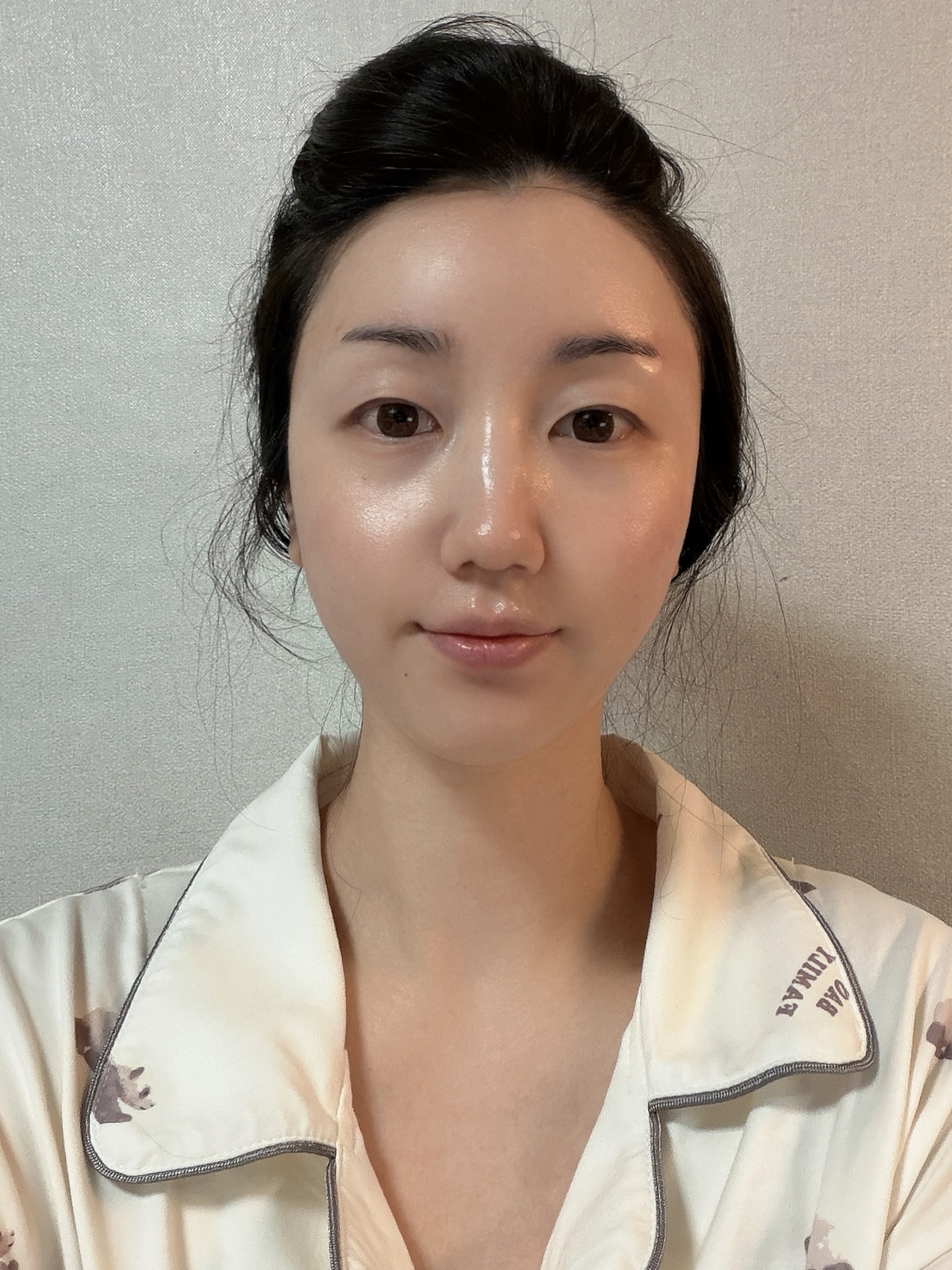 얼굴라인 정리 튠페이스 리프팅