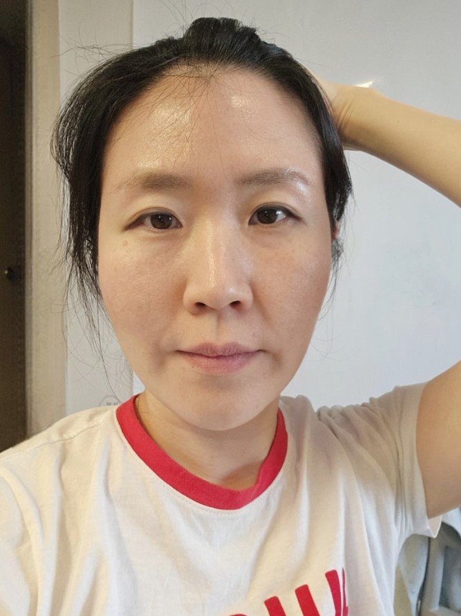 스컬트라 관자 후기