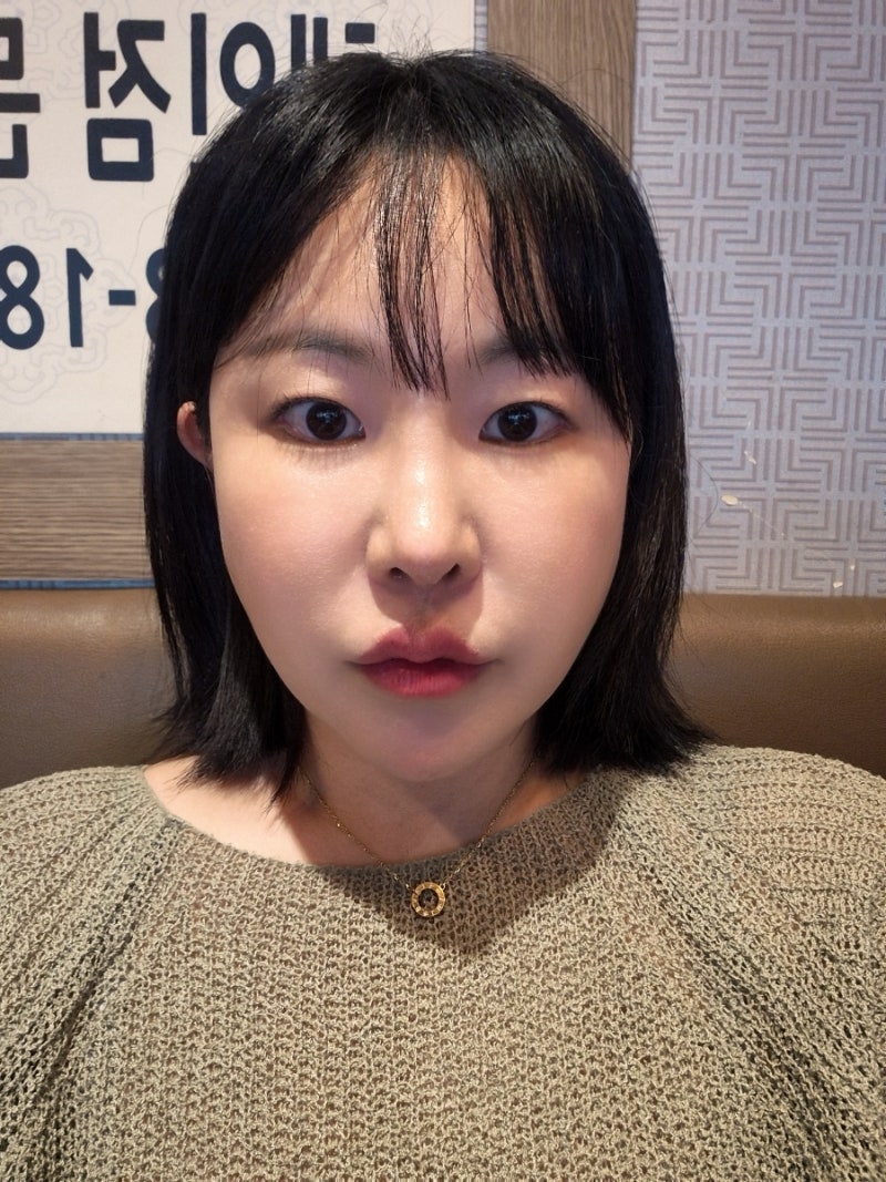 슈링크 300샷 내돈내산 찐리뷰