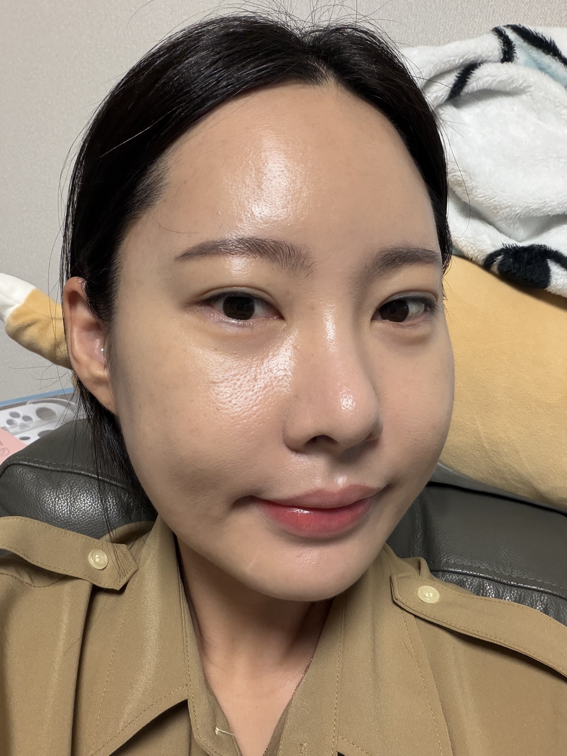 스킨보톡스 7일차 후기