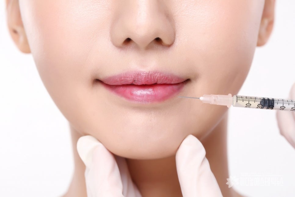 강남역입술필러 후 '붕어 입술' 될까 겁난다면? 0.1cc의 차이를 확인하세요