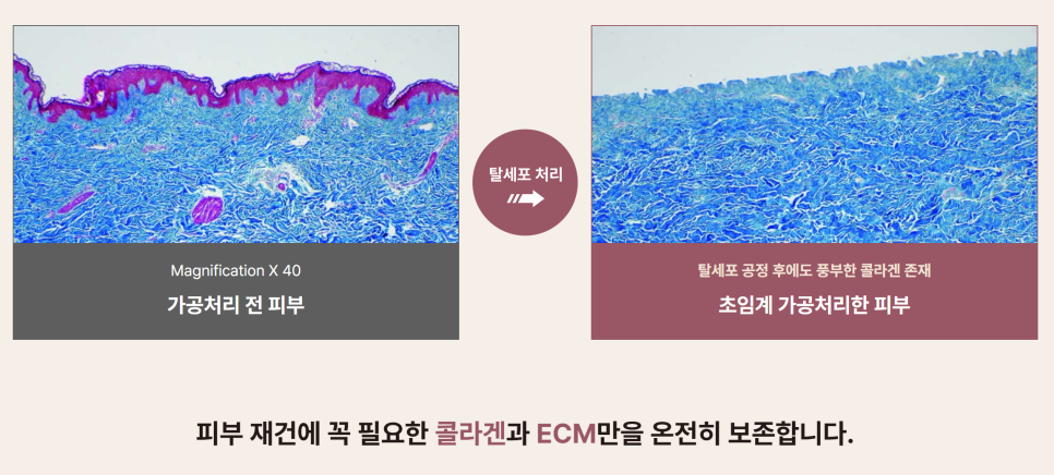 쥬브아셀 가격 8% 효과가 좋을까